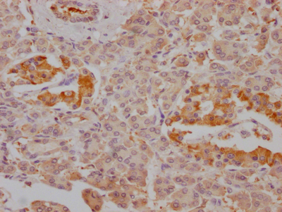 FBP1 Antibody