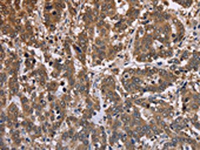 FBP2 antibody