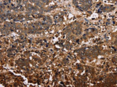 FBP2 Antibody