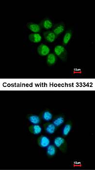 Fbp5B antibody