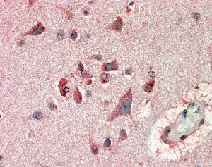Goat anti-FBL2 / FBXL2 Antibody