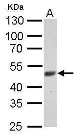 F-box and leucine rich repeat protein 3 Antibody