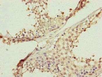FBXL5 Antibody