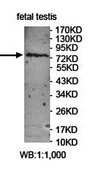 FBXL5 antibody