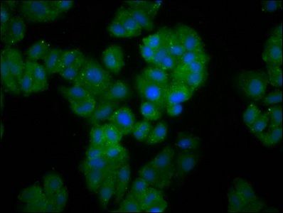 FBXO10 antibody