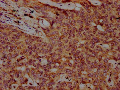 FBXO10 Antibody