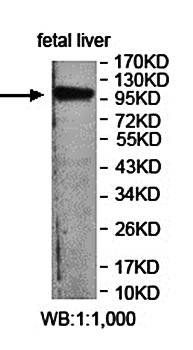 FBXO10 Rabbit Polyclonal Antibody