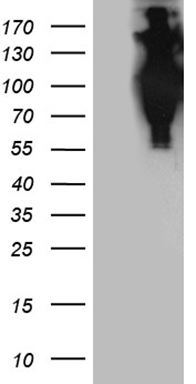 FBXO25 Antibody
