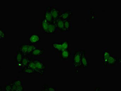 FBXO25 Antibody