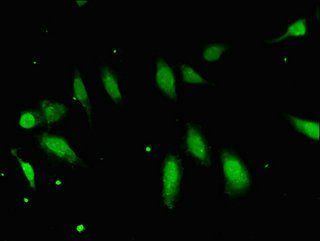 FBXO25 Antibody