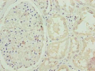 FBXO25 Antibody
