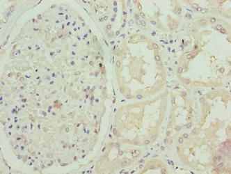 FBXO25 antibody