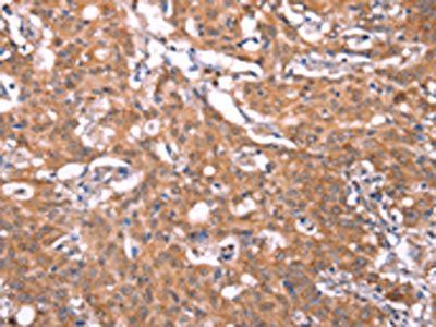 FBXO31 Antibody