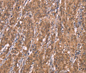 FBXO31 Rabbit Polyclonal Antibody