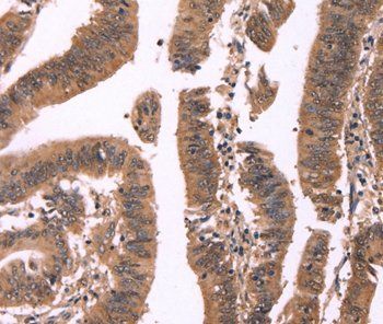 FBXO31 Rabbit Polyclonal Antibody