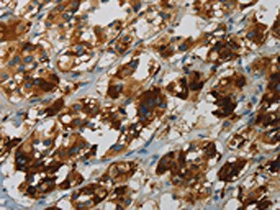 FBXO32 Antibody