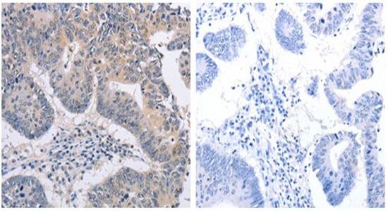 FBXO32 Rabbit Polyclonal Antibody