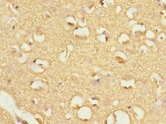 FBXO4 Antibody