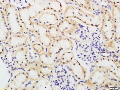 FBXO42 Rabbit Polyclonal Antibody