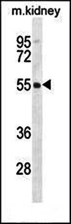 FBXO47 antibody
