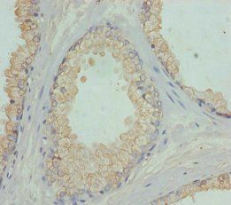FBXO7 Antibody