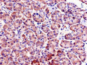 FBXO9 Antibody