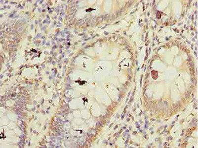 FBXW10 Antibody