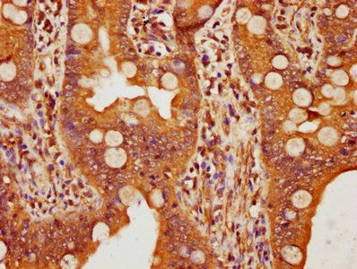 FBXW11 Antibody