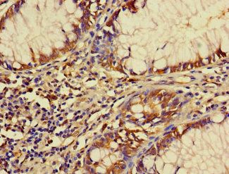 FBXW12 Antibody