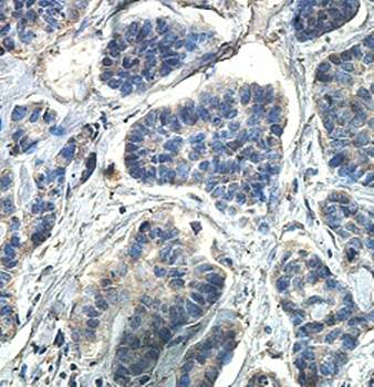 FBXW12 Rabbit Polyclonal Antibody