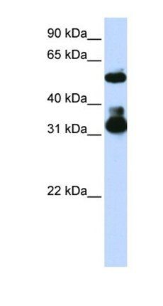 FBXW2 antibody