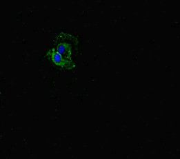 FBXW5 antibody