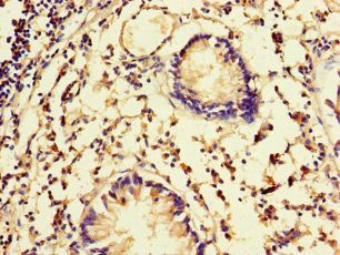 FBXW5 Antibody
