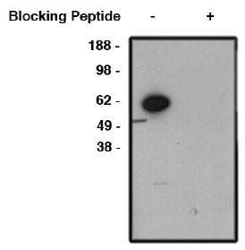 Rabbit Human FBXW7 Antibody