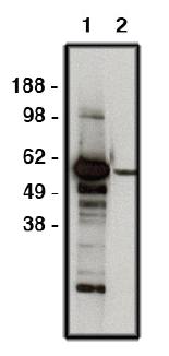 Rabbit Human FBXW7 Antibody