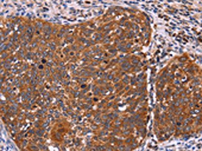 FBXW7 Antibody