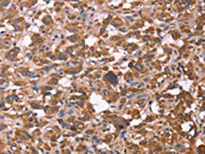 FBXW7 antibody