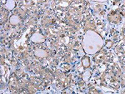 FCAR Antibody