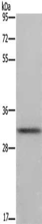 FCAR antibody