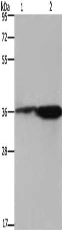 FCAR antibody