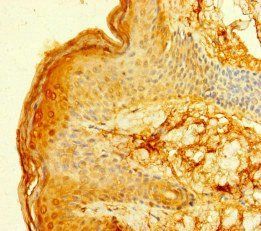 FCER1A Antibody