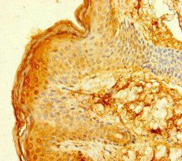 FCER1A antibody