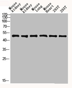 FCGR1A antibody