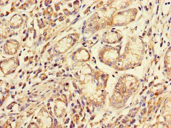 FCGR2A Antibody