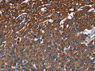 FCGR3A Antibody