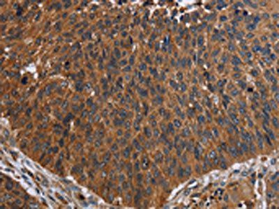 FCGR3A Antibody