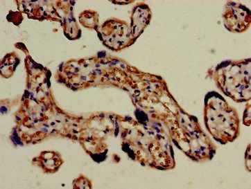 FCGR3A Antibody