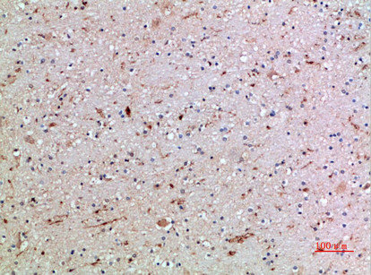 FCGR3A/FCGR3B Antibody
