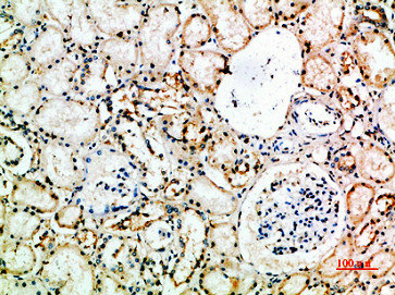 FCGR3A/FCGR3B Antibody