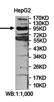 FCHO1 Rabbit Polyclonal Antibody